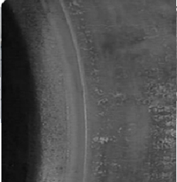 04-ارتداء غير طبيعي من جانب واحد